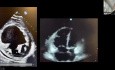 Hocus Pocus: Using POCUS for Volume & Hemodynamics Assessment and Quick Peculiar Diagnoses