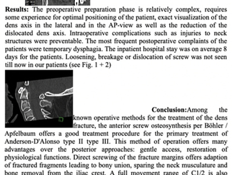 Ventral Screw Osteosynthesis in Dens Fracture (Odontoid Fracture) Type II - III according to Anderson-D'Alonso in Patients over 40 years 10-year Results