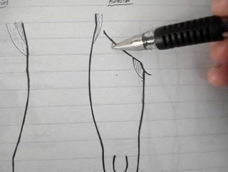Anatomy Lectures - Lumbosacral Plexus - 2/5