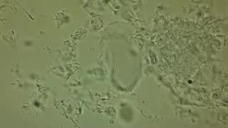 Postcoital Test (PCT) - In Vivo - 3h