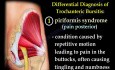 Trochanteric Bursitis - Description and Treatment