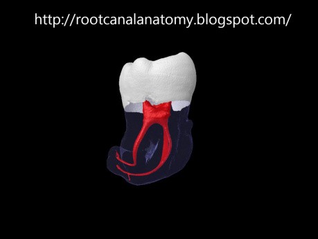 Mandibular Third Molar - Root Canal Anatomy