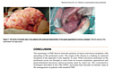 Pseudomyxoma Peritonei - Publication About the Historical Concepts in this Disease WJGS