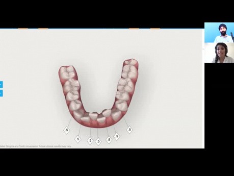 IPR Techniques with an Orthodontist