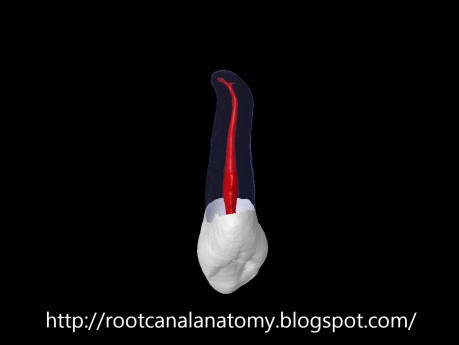 Maxillary Canine - Root Canal Anatomy