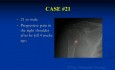 Orthopedic Oncology Course - Unknown Test Cases Part C (21-29) - Lecture 13