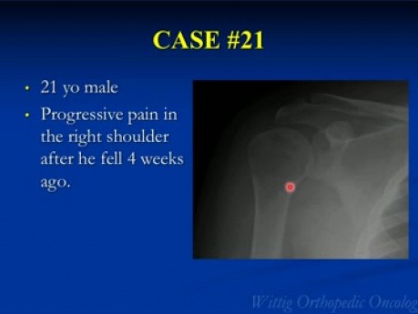 Orthopedic Oncology Course - Unknown Test Cases Part C (21-29) - Lecture 13