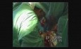 Cardioesophageal Cancer Surgery