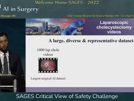 SAGES Critical View of Safety Challenge