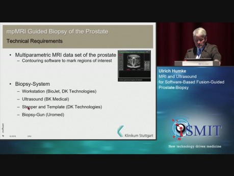 MRI an Ultrasound for Software-Based Fusion-guided Prostate Biopsy - SMIT 2019