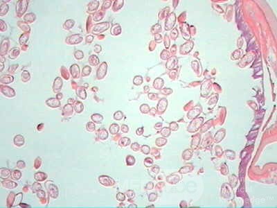 Trichuris Trichuris (whipworm) (12 of 19)