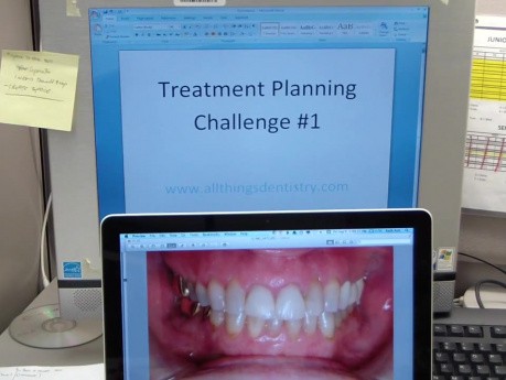 Treatment Planning Challenge #1
