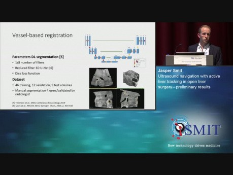 Ultrasound Navigation with Active Liver Tracking in Open Liver Surgery - Preliminary Results - SMIT 2019