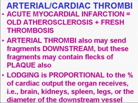 Hemodynamic Disorders, Thromboembolic Disease and Shock - MSP - 4h