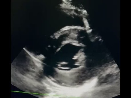 Can You Guess the Echocardiography Case?