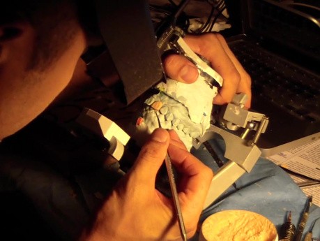 Diagnostic Waxup Part 13