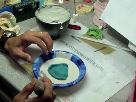 Final Denture Impression Part 1: Preparing To Box With Pumice/Plaster