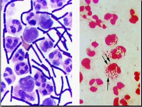 Infectious Diseases - MSP - 8e