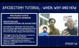 Apicoectomy Tutorial - When, Why and How of Apical Surgery - PDP148