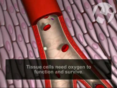 Normal and Occluded Blood Flow