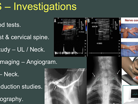 Arteritis, TAO, RP & TOS