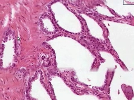 Seminal Vesicles - Histology