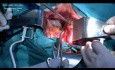 Surgery for Retroperitoneal Malignant Fibrous Histiocytoma of Ileac Region