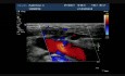 Insufficient Valve in GSV