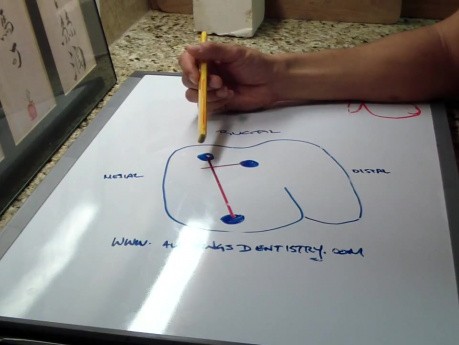 White Board Discussion - MB2 Discovery