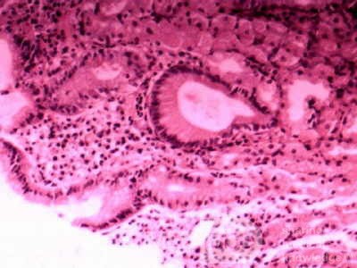 Trichuris Trichuris (whipworm) (9 of 10)