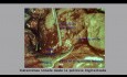 Ended Ectopic Abdominal Pregnancy