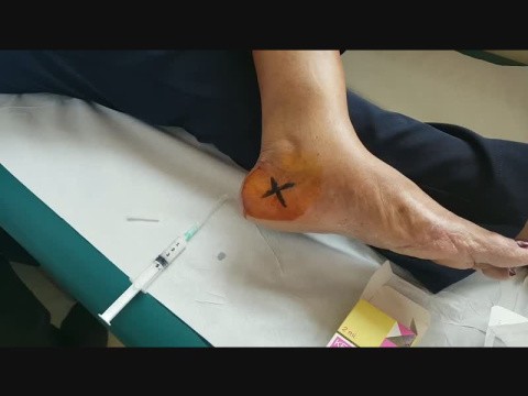 Orthopedy