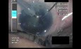 Cataract Surgery V - Part 3