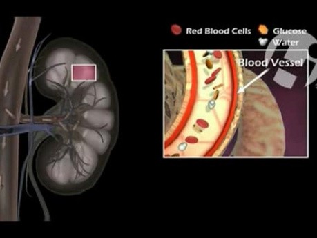 Nephropathy