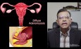 Fibroid and Adenomyosis - What is the Difference?
