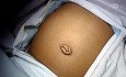 Kasai Roux-En-Y Porto-enterostomy for Biliary Atresia (Open)