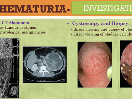 Urology / Hematuria / Renal & Ureteric Colic / Bladder Outlet Obstruction