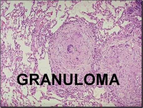Infectious Diseases - MSP - 8j