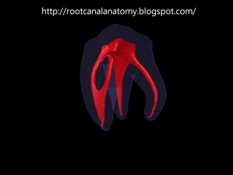 Mandibular Second Molar - Radix