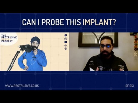 Can I Probe This Implant?
