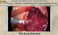 The Dead Stomach