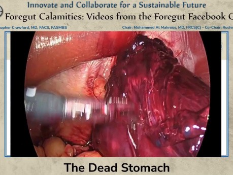 The Dead Stomach
