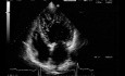 LV Noncompaction