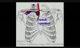 Transcervical Approach For Resection Of Lung Tumors Invading The Thoracic Inlet Sparing The Clavicle