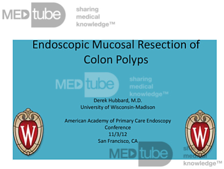 Endoscopic Mucosal Resection of Colon Polyps