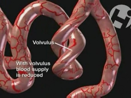 Peristalsis and Nutirent Absorption in the Bowel
