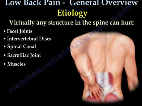 Low back Pain - causes and treatment methods