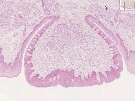 Tongue Circumvallate Papilla - Histology