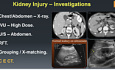 Urological Trauma & Infections