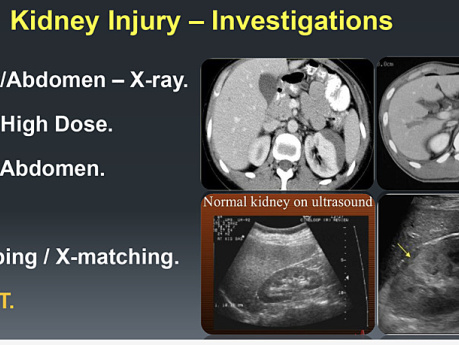 Urological Trauma & Infections